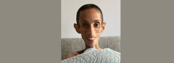Fundraiser Launched for Upper West Side Woman Suffering Life-Threatening Intestinal Disorder
