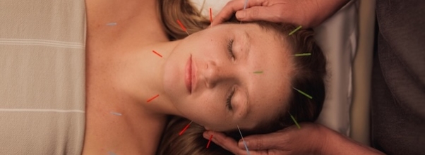 Facial Acupuncture at WTHN Brings Natural Lift to the Upper West Side Facial Acupuncture at WTHN Brings Natural Lift to the Upper West Side